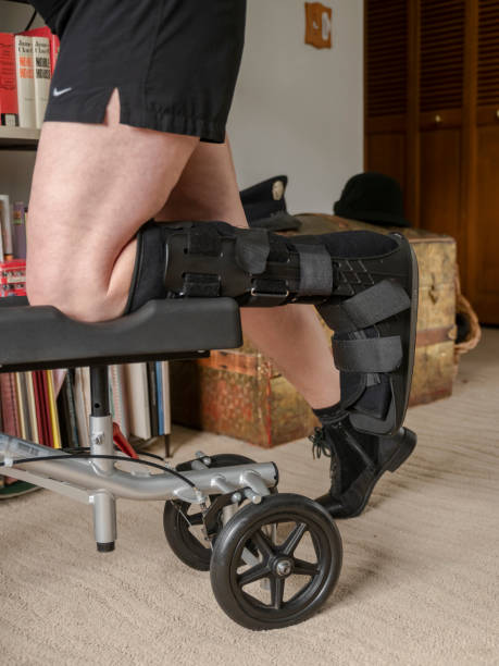 Should you Rent a Knee Walker?